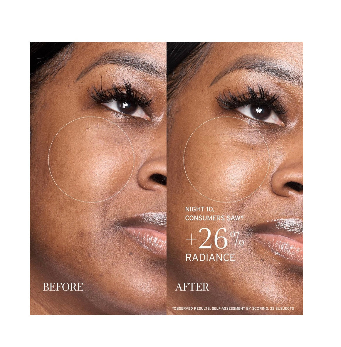 fresh Lotus AHA Resurfacing Gentle Serum