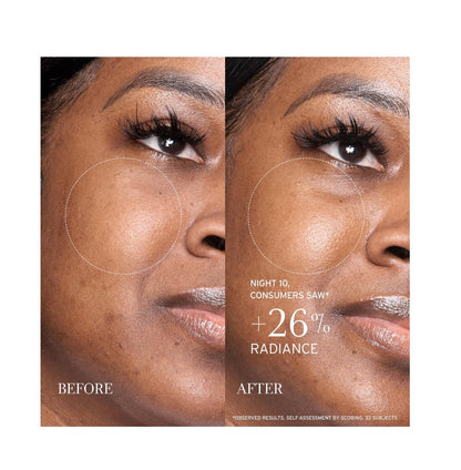 fresh Lotus AHA Resurfacing Gentle Serum