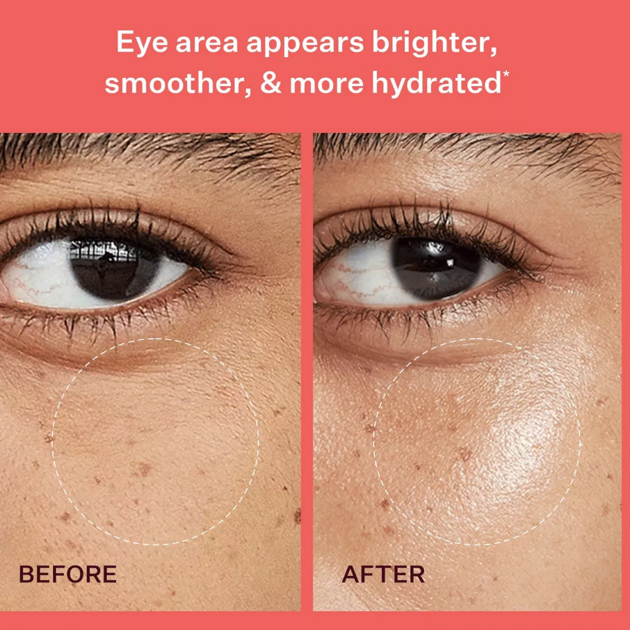 Peach & Lily Pure Peach Retinoic Eye Cream 0.67 fl oz / 20 mL – Brighten + Tighten