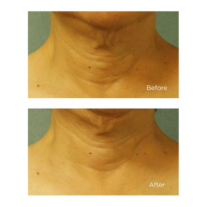 Perricone MD Cold Plasma Plus+ Neck & Chest SPF 25 1.0 Oz