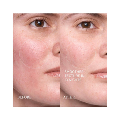 fresh Lotus AHA Resurfacing Gentle Serum