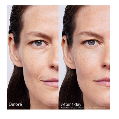 Shiseido Bio-Performance Skin Filler Serum Duo – Anti-Aging Hyaluronic Acid Treatment