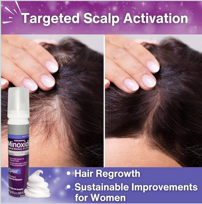 Minoxidil 5% Hair Regrowth Foam for Women – Unscented | 2-Month Supply